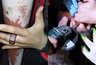 Во Владимире спасателям пришлось вызволять 11-летнего мальчика, засунувшего палец в приваренную к столбу гайку
