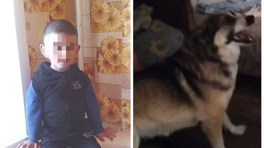 Главная картинка новости: Во Владимирской области собака укусила мальчика в промежность