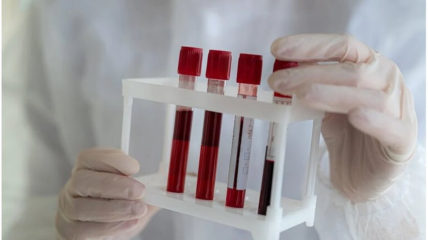 Главная картинка новости: Доктор Мясников раскрыл, за что на самом деле отвечает группа крови и как она влияет на нашу жизнь