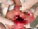 Хирурги Владимирской ОДКБ спасли зубы мальчику после несчастного случая