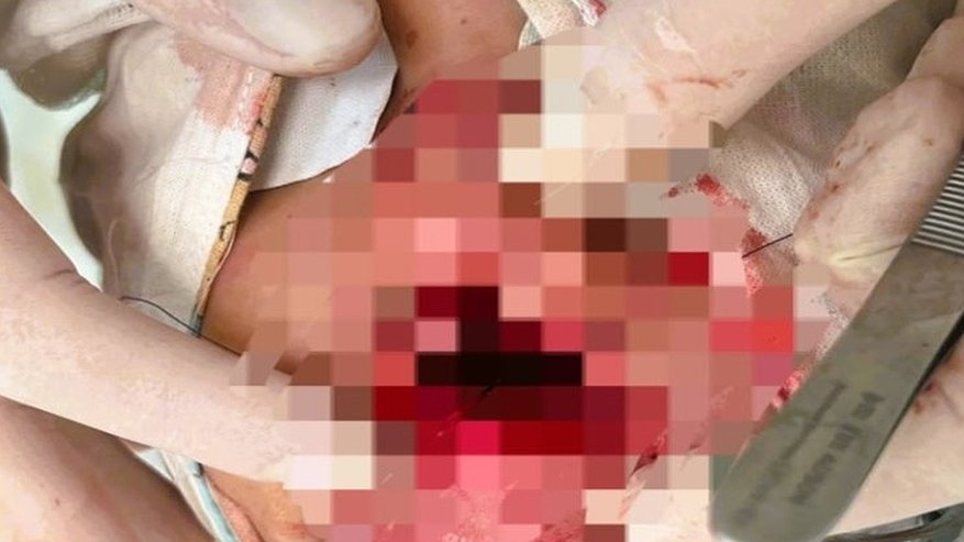 Главная картинка новости: Хирурги Владимирской ОДКБ спасли зубы мальчику после несчастного случая
