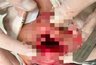 Миниатюра новости: Хирурги Владимирской ОДКБ спасли зубы мальчику после несчастного случая