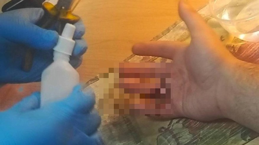 Главная картинка новости: Спортсмен получил травму при занятиях на турнике